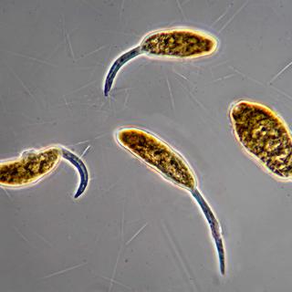 Des larves d'un verre plat de la famille des Schistosomatidae.
Christian Gautier/Biosphoto
AFP [AFP - Christian Gautier/Biosphoto]