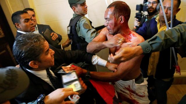 Un supporter du gouvernement vénézuélien blessé dans la bagarre générale provoquée par l'irruption d'un groupe de partisans de Nicolas Maduro dans les locaux du Parlement. [REUTERS - Carlos Garcia Rawlins]