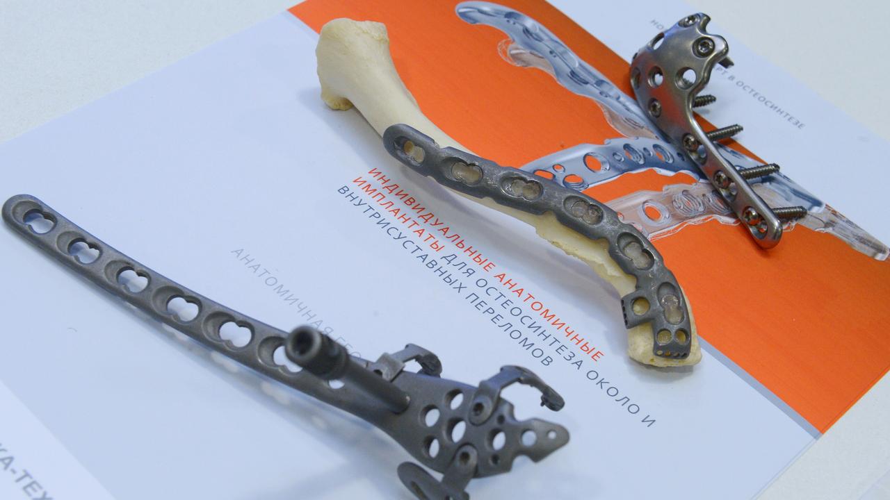 Des implants anatomiques pour des fractures intra-articulaires de fabrication russe. (Image d'illsutration)