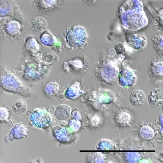 Cellules immunitaires ayant ingéré des nanoparticules de soie d’araignée - en vert. Les endosomes - la partie de la cellule dans laquelle les nanoparticules relâchent le vaccin – apparaissent en bleu.
Carole Bourquin
Unige [Unige - Carole Bourquin]