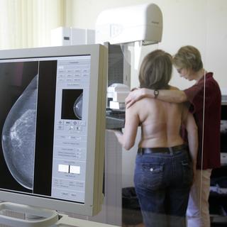 Le dépistage systématique du cancer du sein s’effectue par une mammographie tous les 2 ans dès l’âge de 50 ans et jusqu’à 74 ans. [AP/Keystone - Franka Bruns]