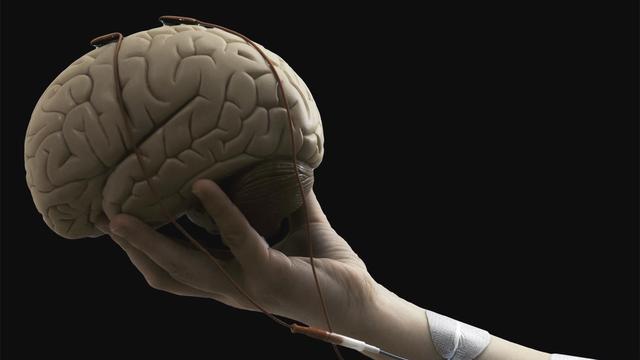 Des chercheurs de l’EPFL ont démontré qu’en associant une interface cerveau-machine (BCI) et la stimulation électrique fonctionnelle (FES), des victimes d’accident vasculaire cérébral recouvraient un plus grand usage de leur bras paralysé, même des années après l’événement.
CNBI
EPFL [EPFL - CNBI]