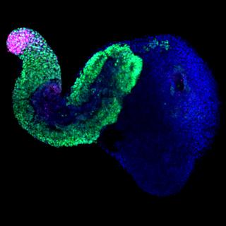 Gastruloïde âgé de 7 jours. Les noyaux cellulaires sont en bleu. Les cellules progénitrices neurales en vert. Celles du bourgeon de la queue en rose. [EPFL - Mehmet Girgin]