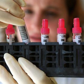 Le nombre de tests de dépistage du HIV a augmenté de 11% l'an dernier en Suisse. [Keystone - Fabrice Coffrini]
