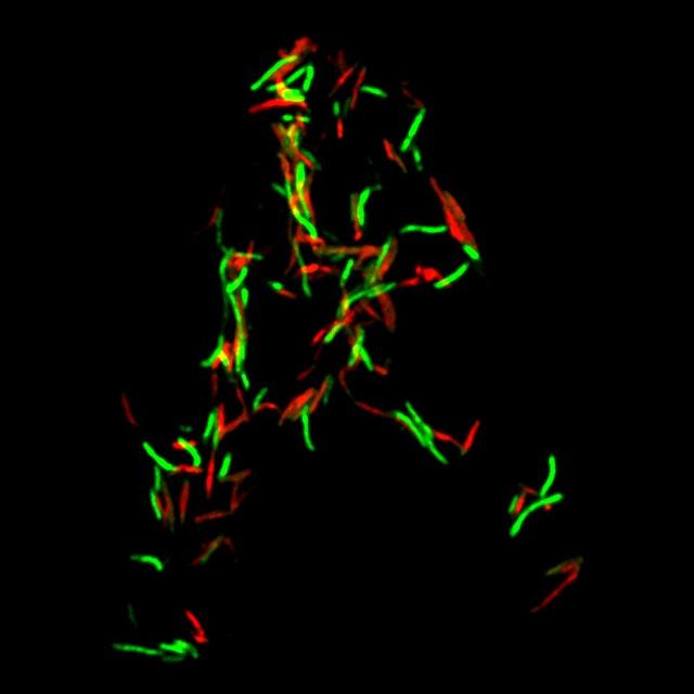 Lorsque la toxine MbcT est produite sans son antidote, elle induit la mort des bactéries (marquées en rouge).
Antonio Peixoto, Claude Gutierrez et Olivier Neyrolles
IPBS/CNRS-UT3–Paul Sabatier [IPBS/CNRS-UT3–Paul Sabatier - Antonio Peixoto, Claude Gutierrez et Olivier Neyrolles]