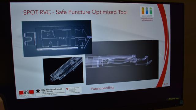 Dotée de ressorts et de lames flexibles, cette minuscule aiguille doit permettre d'atteindre les veines de la rétine. [RTS - Gaël Klein]