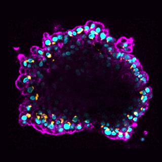 Structure tridimensionnelle glandulaire reconstituée par des cellules épithéliales mammaires produisant des fibres branchées en excès. 
Image accompagnant le cp
Molinie et al.
Cell Res [Cell Res - Molinie et al.]