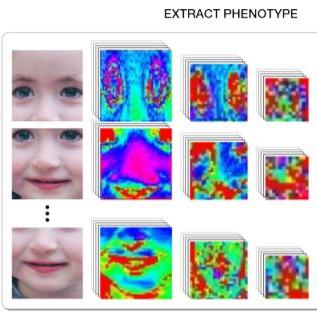 DeepGestalt analyse une image selon certains points précis, la compare avec une base de données, et donne des similarités avec des syndromes connus. [arxiv.org - DeepGestalt]