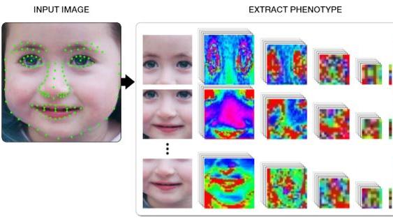 DeepGestalt analyse une image selon certains points précis, la compare avec une base de données, et donne des similarités avec des syndromes connus. [arxiv.org - DeepGestalt]