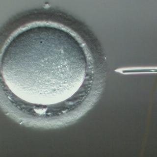 Injection d'un spermatozoïde dans un ovule [keystone - Gaetan Bally]