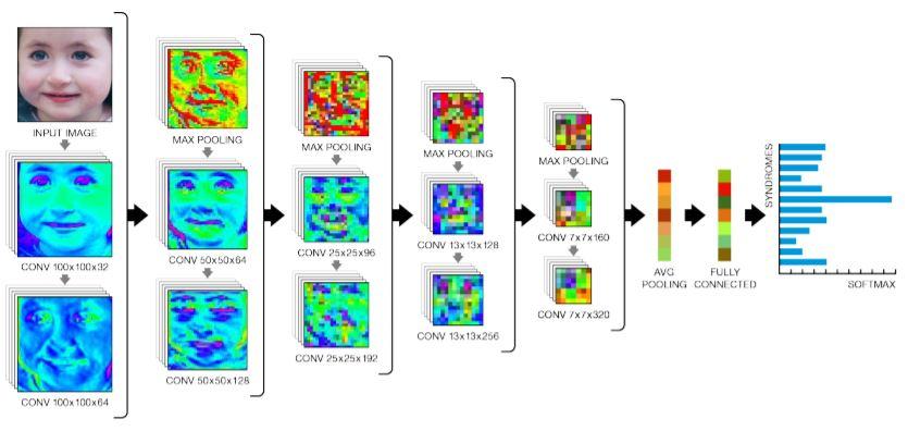 DeepGestalt analyse les images par couches. [arxiv.org - DeepGestalt]