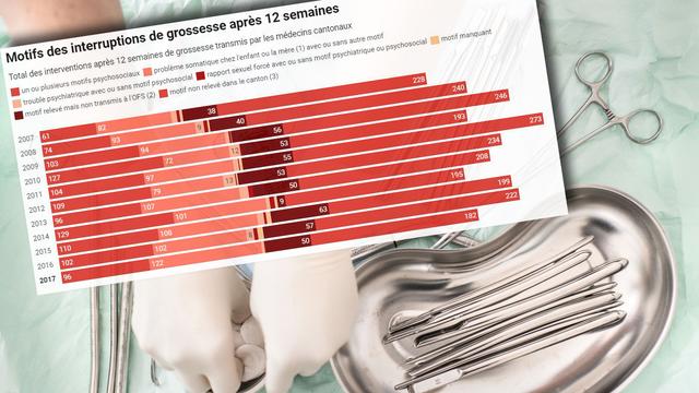 Environ 150 avortements par année sont pratiqués au-delà de la 17e semaine de grossesse. [Keystone - Christian Beutler]