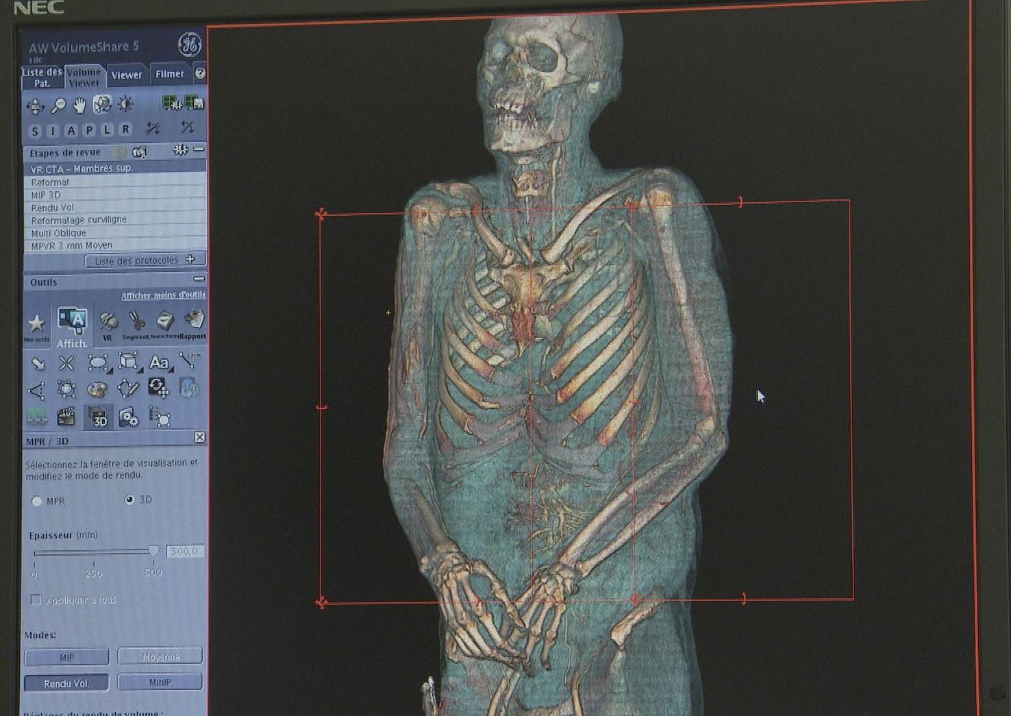 L'autopsie virtuelle permet de voir plusieurs couches du corps humain à la fois ou séparément. [RTS]