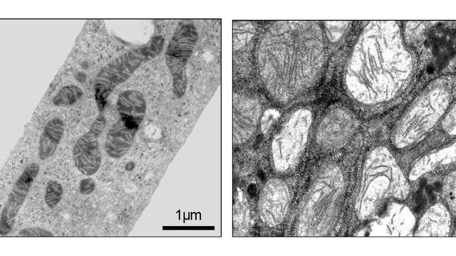 Mitochondries de cellules du foie en microscopie électronique. 
Pierre Maechler
Unige [unige - Pierre Maechler]