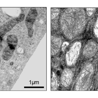 Mitochondries de cellules du foie en microscopie électronique. 
Pierre Maechler
Unige [unige - Pierre Maechler]
