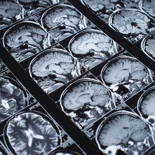 Pour arriver à ses conclusions, les chercheurs ont analysé 4'000 images de cerveau prises par IRM.
LarisaBozhikova
Depositphotos [Depositphotos - LarisaBozhikova]