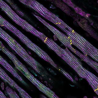 Immuno-marquage de cellules du muscle cardiaque de souris sous anoxie.
Howard Riezman
Unige [Unige - Howard Riezman]