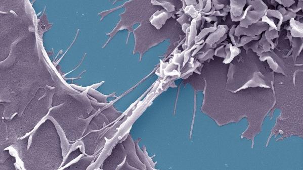 Nanotubes entre deux macrophages humains infectés par le VIH-1 dans un environnement tuberculeux.
Shanti Souriant & Renaud/Poincloux, IPBS, CNR
Université Toulouse III-Paul Sabatier [Université Toulouse III-Paul Sabatier - Shanti Souriant & Renaud/Poincloux, IPBS, CNR]