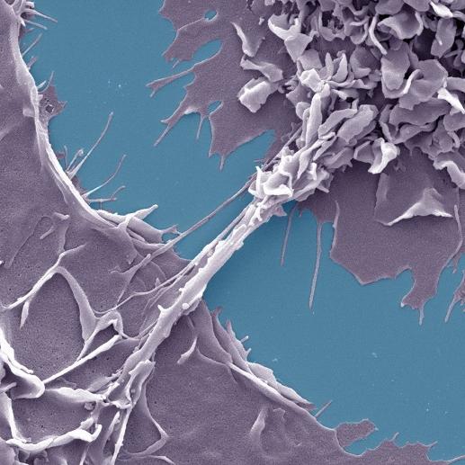 Nanotubes entre deux macrophages humains infectés par le VIH-1 dans un environnement tuberculeux.
Shanti Souriant & Renaud/Poincloux, IPBS, CNR
Université Toulouse III-Paul Sabatier [Université Toulouse III-Paul Sabatier - Shanti Souriant & Renaud/Poincloux, IPBS, CNR]