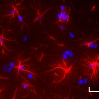 Quatre semaines après le début de la maladie du foie, les cellules astrocytaires (en rouge) dans le cerveau des rats malades présentent une morphologie altérée, avec raccourcissement et diminution du nombre de leurs prolongements (barre d’échelle : 25 µm).
Katarzyna Pierzchala
Unige [Unige - Katarzyna Pierzchala]