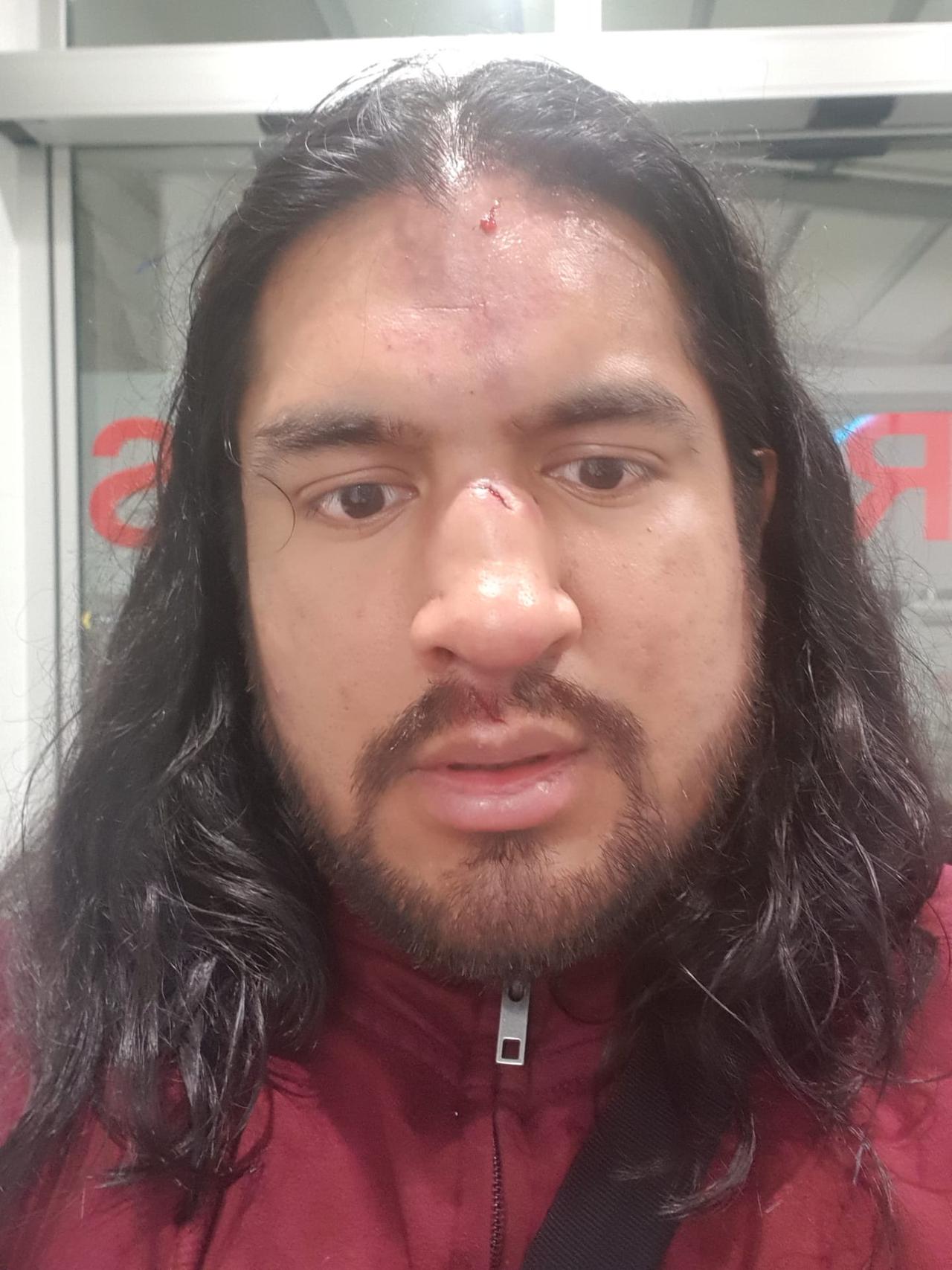 Blessure de Victor Diaz après un show à TRamelan (BE). [Geneva Total Wrestling]