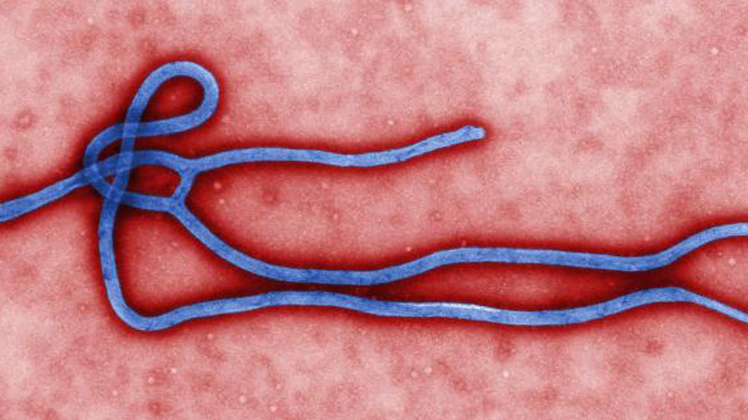 Le virus Ebola a déjà tué plus de 2000 personnes en RDC dans l'épidémie actuelle [AP Photo/CDC, File]
