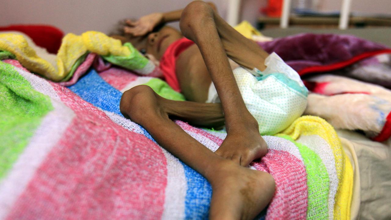 Le Yémen est l'un des pays subissant les pires crises alimentaires. [Keystone - Yahya Arhab]
