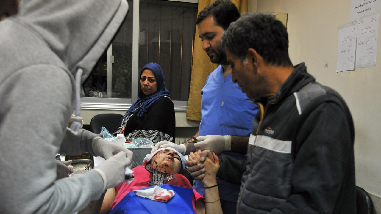 Un blessé dans un hôpital de Damas après les frappes israéliennes, ce 20 novembre. [Epa - Sana]