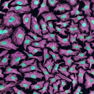 Image au microscope de cellules HeLa. [AFP - NIH]