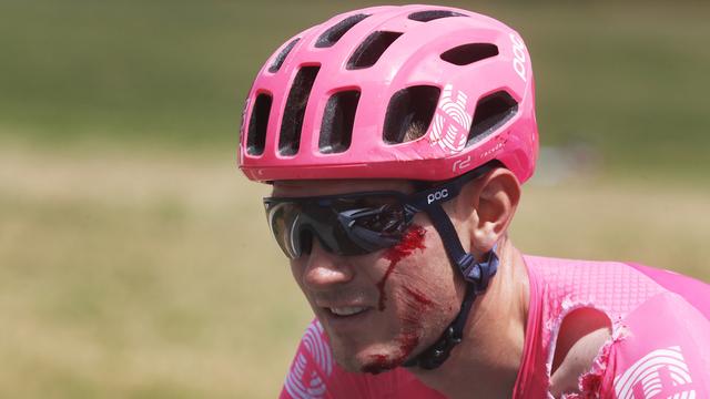 Tejay Van Garderen souffre d'une fracture de la main gauche. [Thibault Camus]