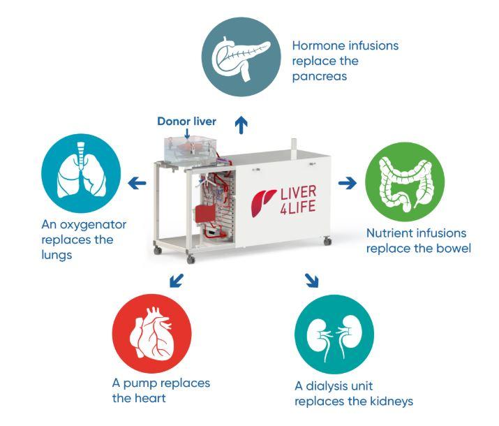 Le système de perfusion remplace des fonctions du corps humains pour maintenir le foie en vie. [Hôpital universitaire de Zurich.]