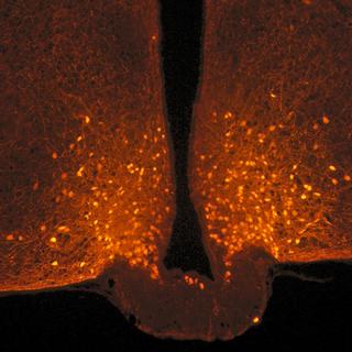 Neurones POMC (points oranges) dans l’hypothalamus, à la base du cerveau. Photo acquise chez la souris avec un microscope confocal.
Danaé Nuzzaci
CNRS/CSGA [CNRS/CSGA - Danaé Nuzzaci]