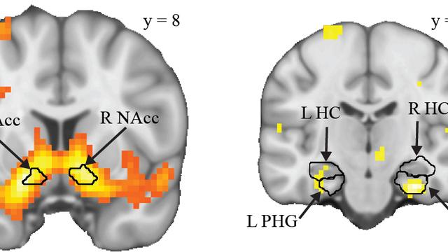 L’optimisation de la consolidation des souvenirs est le produit d’un dialogue neuronal entre le circuit de la récompense (à gauche) et celui de la mémoire (à droite). 
UNIGE [UNIGE]