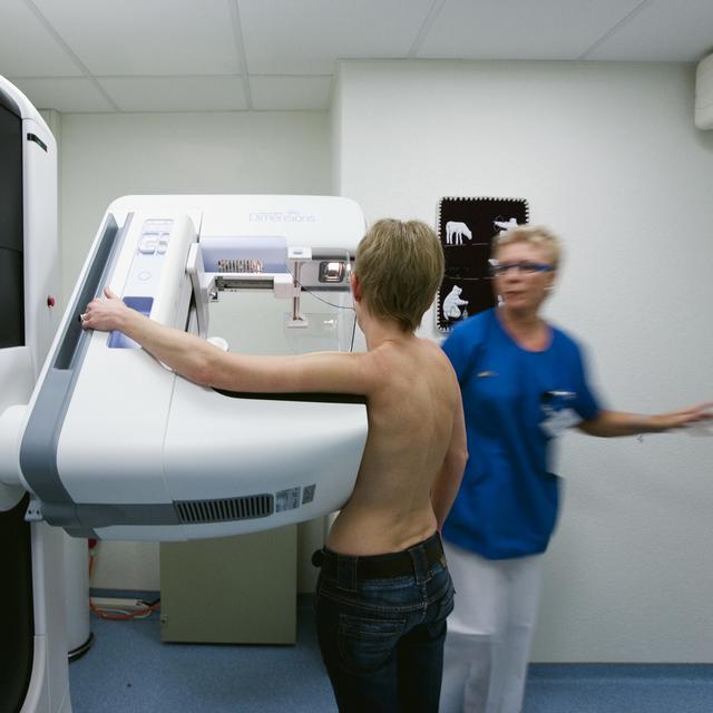 Une patiente subit une mammographie à Berne. [Keystone - Gaetan Bally]