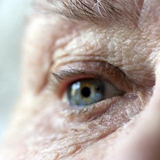La dégénérescence maculaire liée à l’âge (DMLA) touche un quart des personnes de plus de soixante ans.
Joingate
Depositphotos [Joingate]