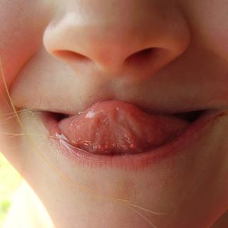 La thérapie myofonctionnelle sollicite les muscles de la langue.
bazil
Depositphotos [bazil]