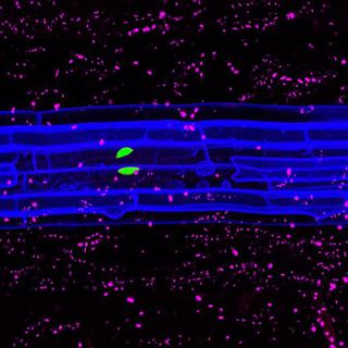 Image en 3D d’une racine d’Arabette des dames (en bleu), entourée de bactéries commensales (en rouge). Une forte réponse immunitaire (en vert) n’a lieu que dans la région lésée. [DBMV-UNIL - Feng Zhou]