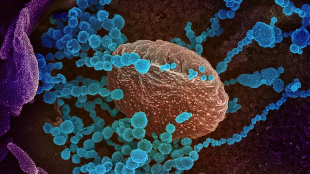 Le SARS-CoV-2 (les petits ronds bleus) vu grâce à la microscopie électronique à balayage. Le virus est aussi connu sous les noms de 2019-nCoV, Covid-19, ou, plus communément, de "coronavirus". [Keystone/epa/niaid-rml - National Institutes of Health (NIH)]