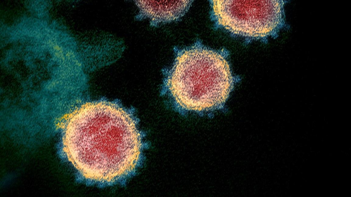 Cette image prise grâce à la Microscopie électronique en transmission montre le SARS-CoV-2, aussi connu sous les noms de coronavirus, Covid-19 et 2019-nCoV. Des particules du virus sont montrées en train d'émerger de la surface des cellules de culture, en laboratoire. Les pointes sur le bord extérieur de la particule sont les éléments qui donnent leur nom au coronavirus: corona, comme couronne. [CC - NIAID-RML]