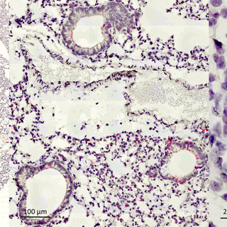 Section de poumon visualisée par microscopie électronique. Les bactéries sont visibles grâce à un marquage rouge et les cellules pulmonaires en gris et violet.
img avec cp unige
Mirco Schmolke
Unige 2020 [Unige 2020 - Mirco Schmolke]