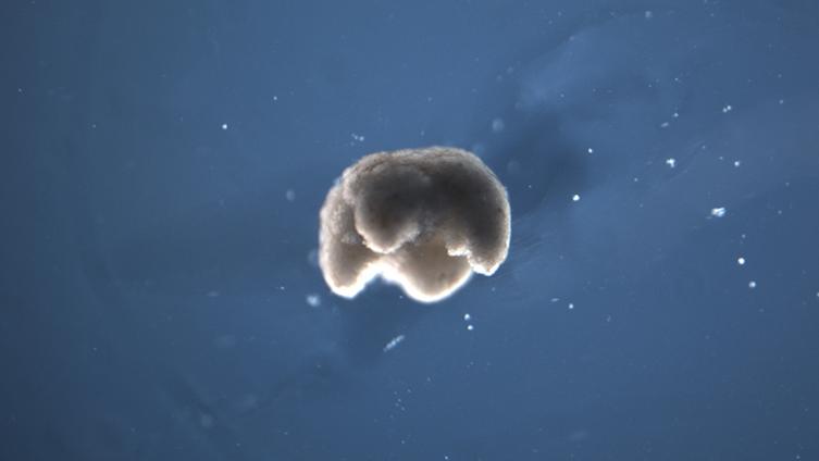 Le xénobot, un organisme quadrupède manufacturé par l'Homme avec des cellules souches de grenouille. Il est un tout petit peu plus petit qu'une tête d'épingle avec son diamètre de 650 à 750 microns. [Tufts University - Douglas Blackiston]