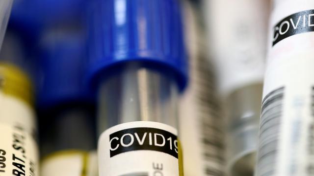 Echantillon destiné à un test du Covid-19 dans un laboratoire (image d'illustration). [Reuters - Denis Balibouse]