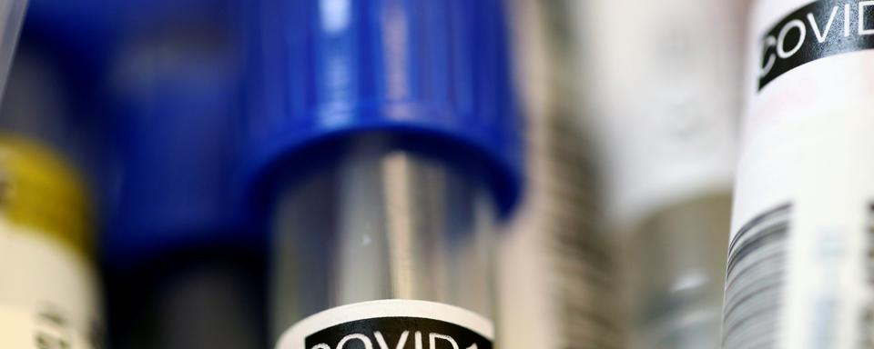 Echantillon destiné à un test du Covid-19 dans un laboratoire (image d'illustration). [Reuters - Denis Balibouse]