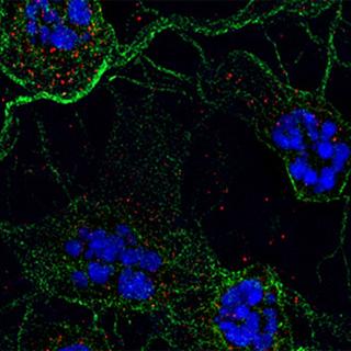 Neurones en culture (en bleu, le noyau, en vert le cytoplasme) avec la visualisation des quadruplexes par imumunodetection (en rouge). [Andrey S. Tsvetkov / McGovern Medical School at Houston]