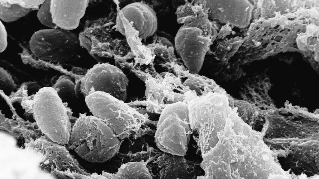La bactérie Yersinia, à l'origine de la peste bubonique. [Keystone - AP Rocky Mountain Laboratories]