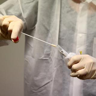 Les tests sérologiques sont-ils fiables pour détecter une contamination passée au coronavirus? [KEYSTONE / POOL REUTERS - DENIS BALIBOUSE]