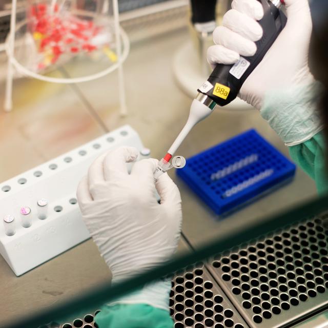Depuis le début de la pandémie, 37'403 cas de contamination au Covid-19 ont été confirmés en laboratoire sur un total de 861'555 tests en Suisse. [Keystone - Gaëtan Bally]