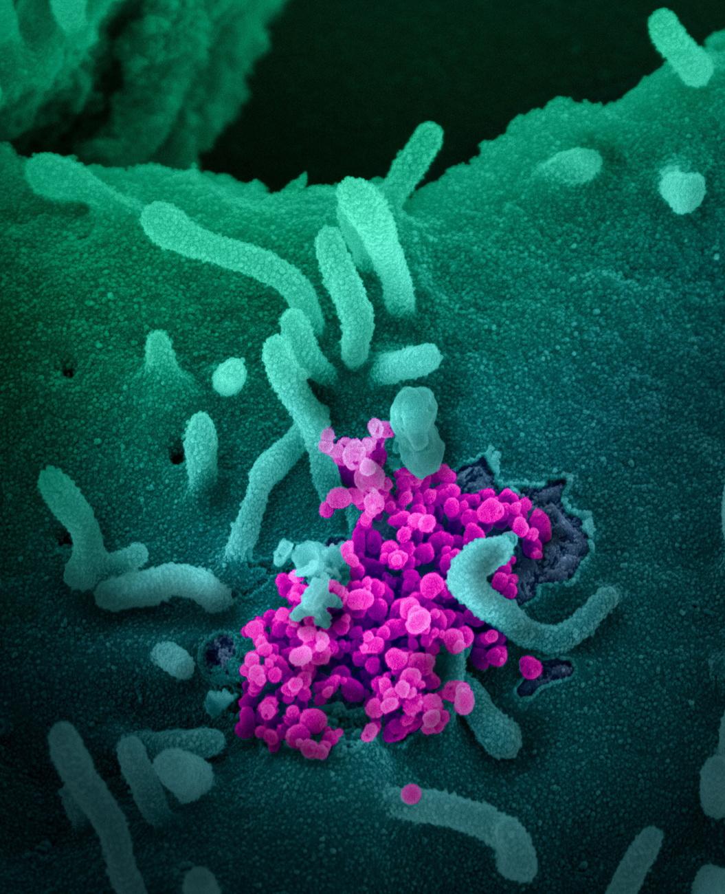 Le SARS-CoV-2 (en rose) vu grâce à la microscopie électronique à balayage. Le virus est aussi connu sous les noms de 2019-nCoV, Covid-19, ou, plus communément, de "coronavirus". [Keystone/epa/niaid-rml - National Institutes of Health (NIH)]