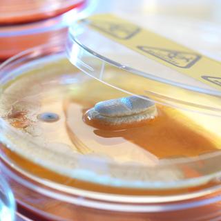 Plusieurs géants pharmaceutiques se sont lancés dans un vaste projet de recherche contre les bactéries résistantes aux antibiotiques. [ABO/AFP]
