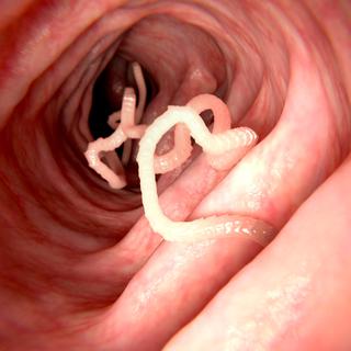 Ténébrion dans l'intestin humain.
animaxx3d
Depositphotos [animaxx3d]